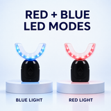 GlorySmile Wireless Teeth Whitening Kit detail 2